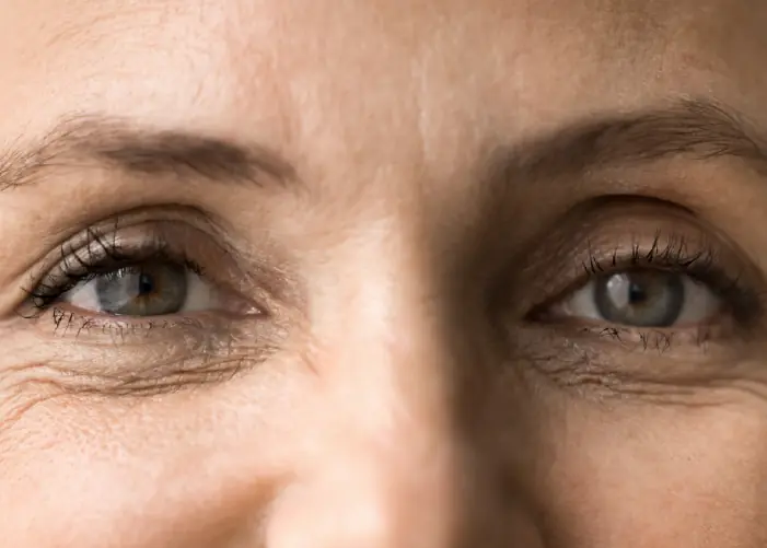Close-up of a woman's eyes – EMDR therapy in London